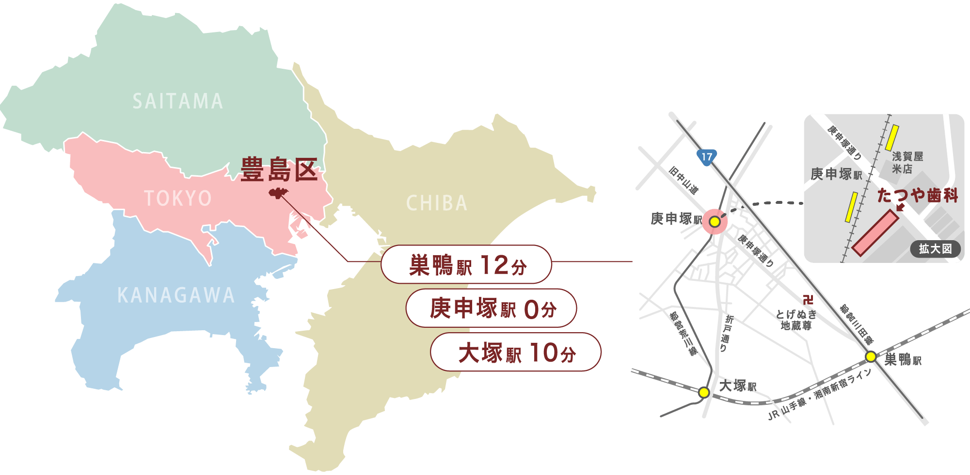 東京都豊島区の部分矯正「たつや歯科」