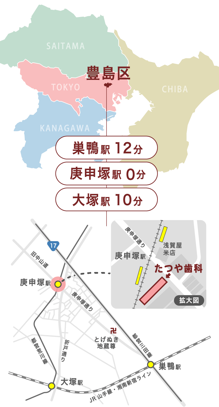 東京都豊島区の部分矯正「たつや歯科」