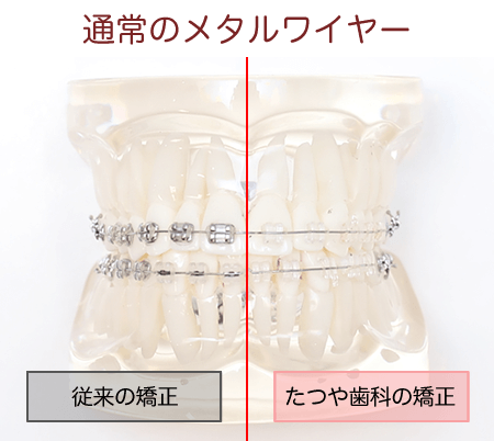 従来のメタルワイヤー