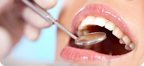 たつや歯科の部分矯正は明確・分かりやすい料金システム