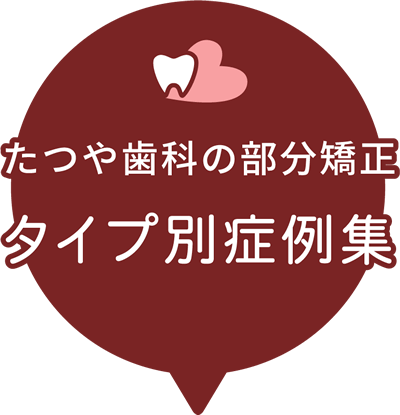 たつや歯科の部分矯正 タイプ別 症例集