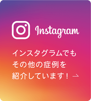 たつや歯科の部分矯正 Instagram