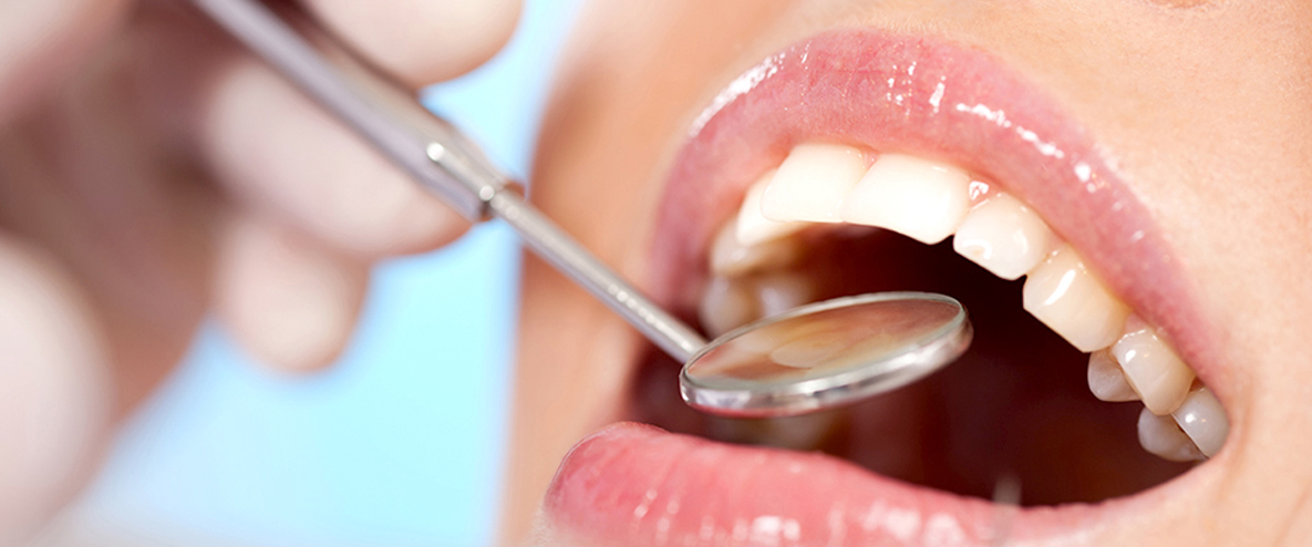 歯の前歯の形態修正